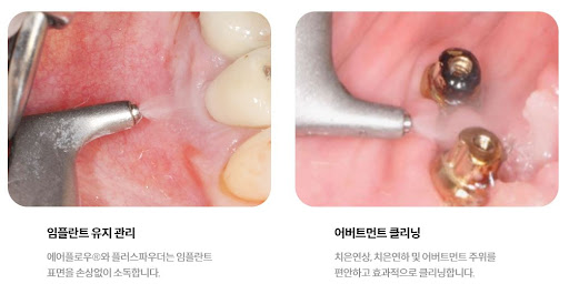 천안 치아교정에 불당치과와 불당본점 서울비디치과의원의 전문 지원
