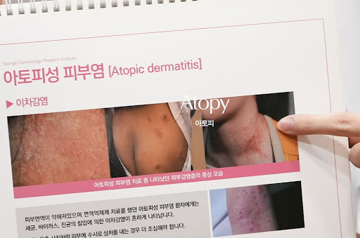 생기한의원으로 보는 성인 아토피 향료·세정제 자극 정보